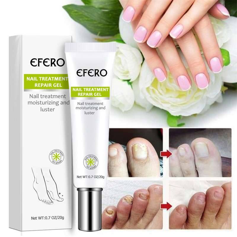 Efero 20g Nail Repair Gel Fungus Treatment Solution Anti Fungal Removal Infection Cuticle Toe Nail Foot Protector Cream TSLM2